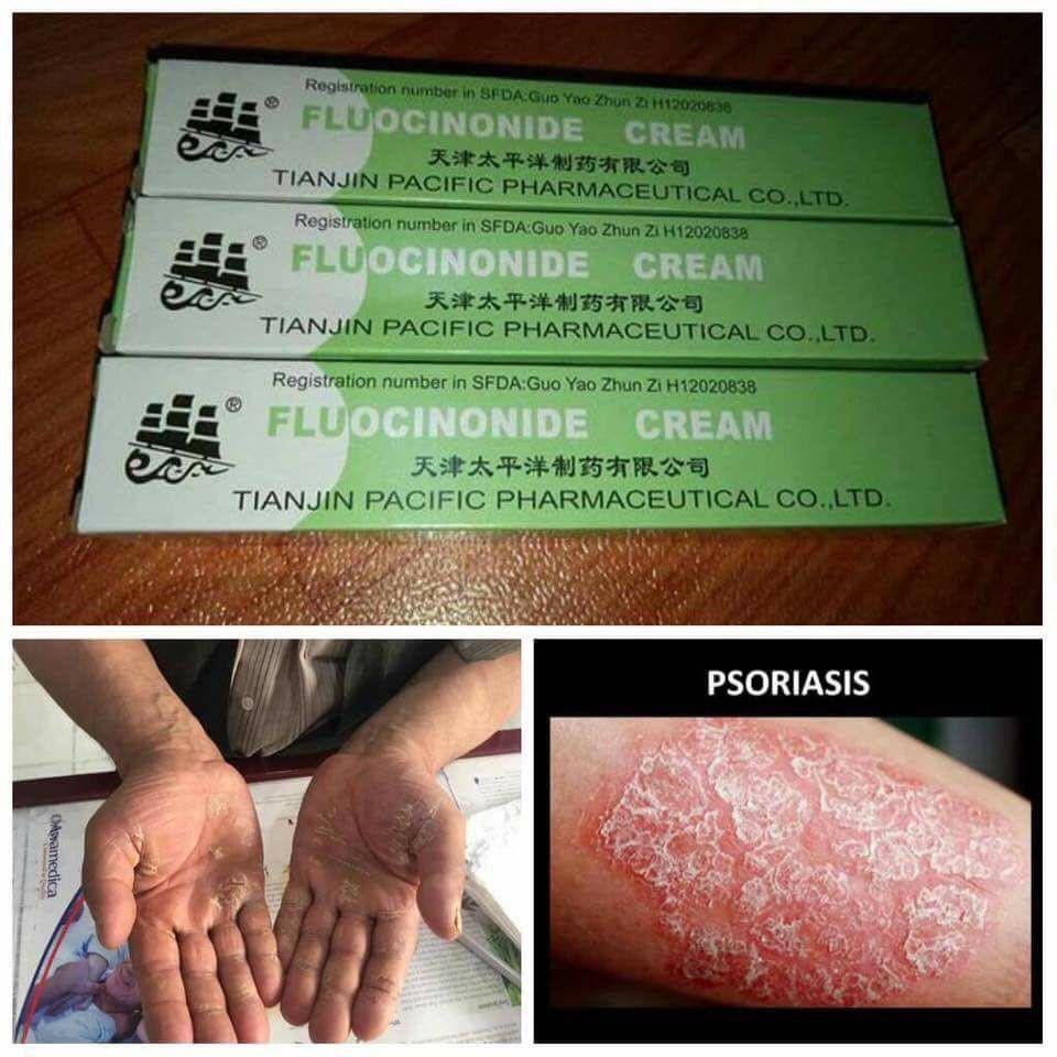 [BUNDLE OF 10 TUBES] ECZEMA CREAM / Fungal Infection / Bacterial