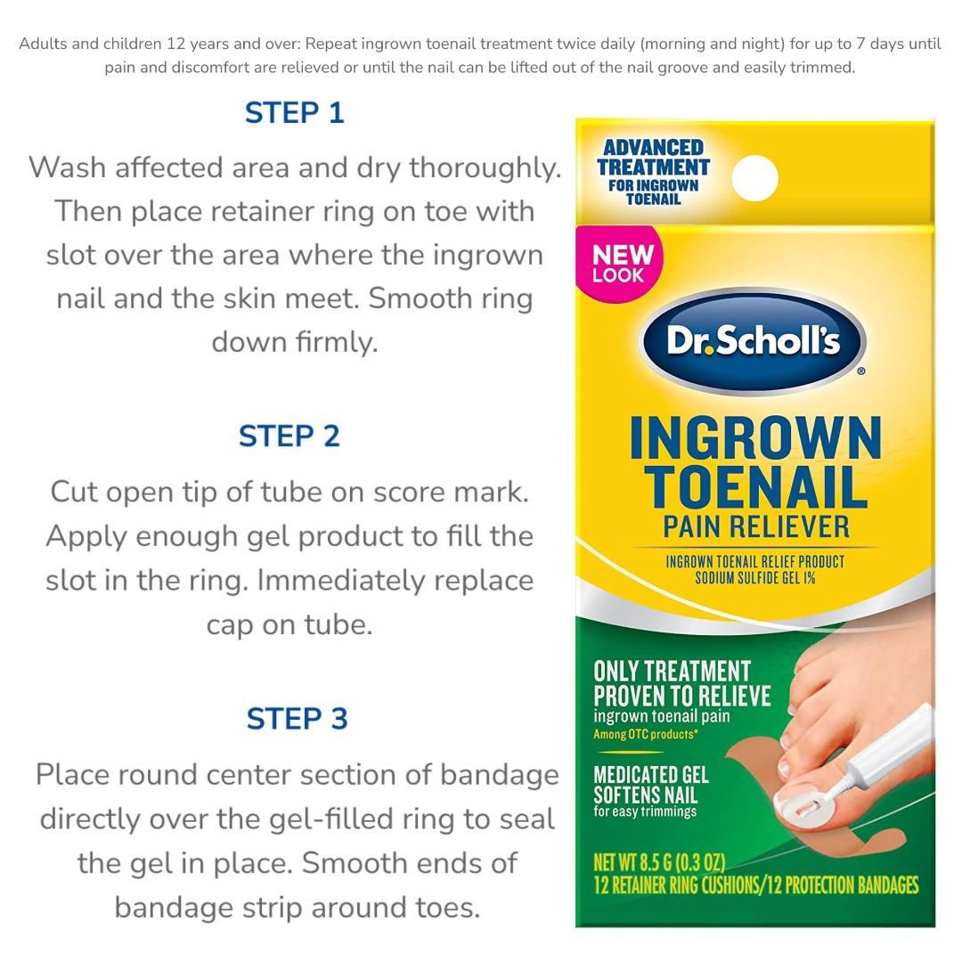 Scholl ingrowing toenail treatment hotsell