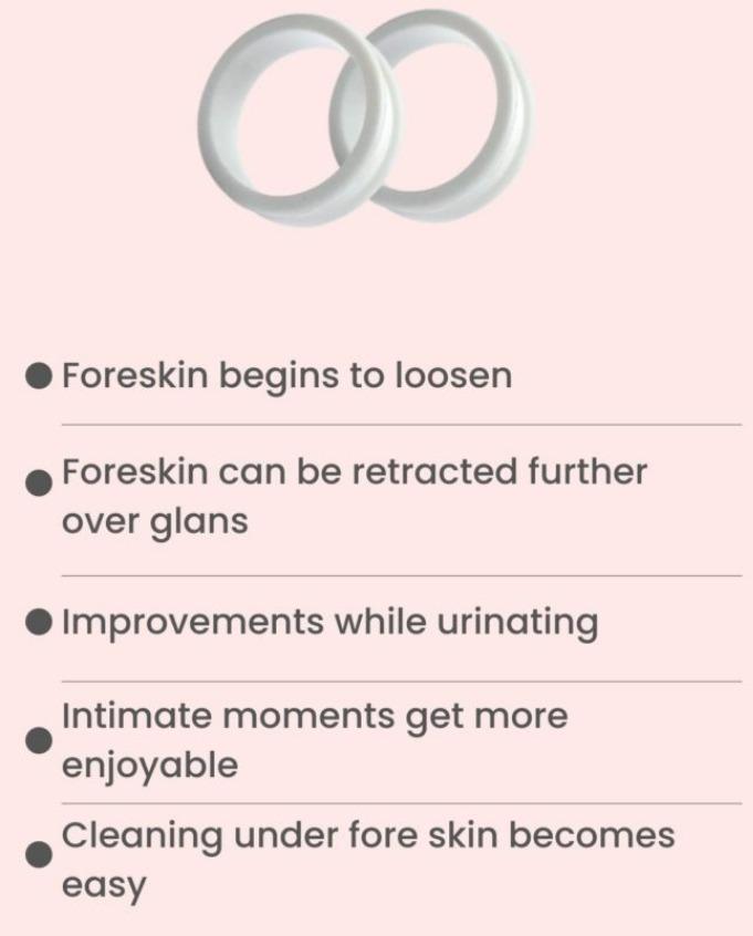 Phimosis stretching rings, forestretch cream, tool & information booklet on treating phimosis