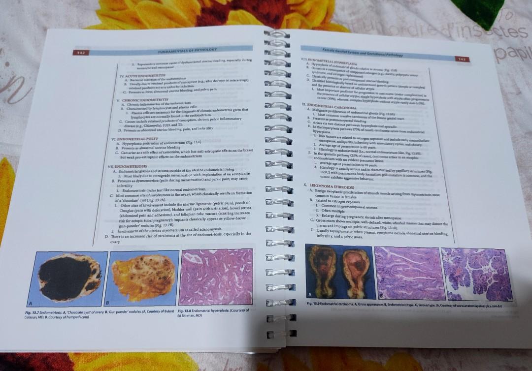 FUNDAMENTALS OF PATHOLOGY 2018 (PATHOMA) (Category: Textbooks) located in Manila. Submitted by rarepenguinph (Listing ID 1182465177, Image 3). Description: ✓High quality prints (COLORED) ✓Coilbound ✓Booklet type ✓With Clear PVC front cover ON THE DAY DELIVERY UPON PAYMENT FOR METRO MANILA BUYERS ONLY MAY SHIP NATIONWIDE (OUTSIDE METRO MANILA) BUT ONLY FOR THOSE WHO ARE WILLING TO WAIT PAYMENT ✓via GCash or Online Bank Transfer DELIVERY >>FOR ON T