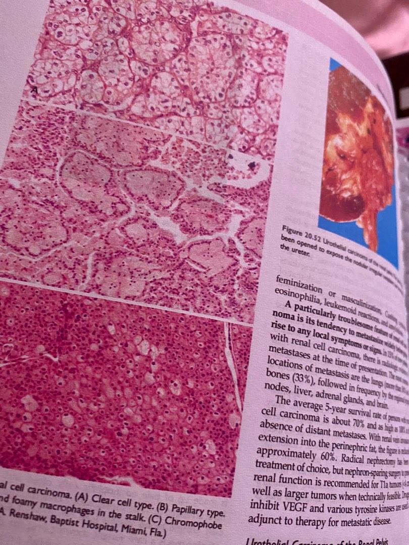 ROBBINS AND COTRAN PATHOLOGIC BASIS OF DISEASE 10TH ED visual data 8