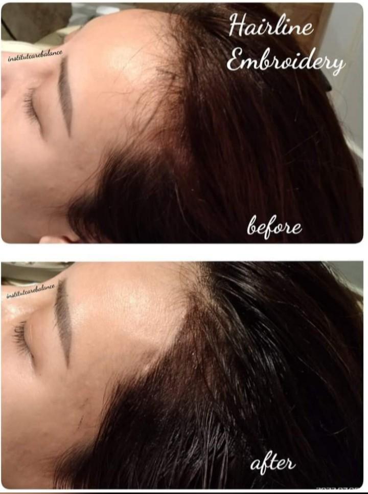 Hairline Embroidery, Lifestyle Services, Beauty & Health Services on