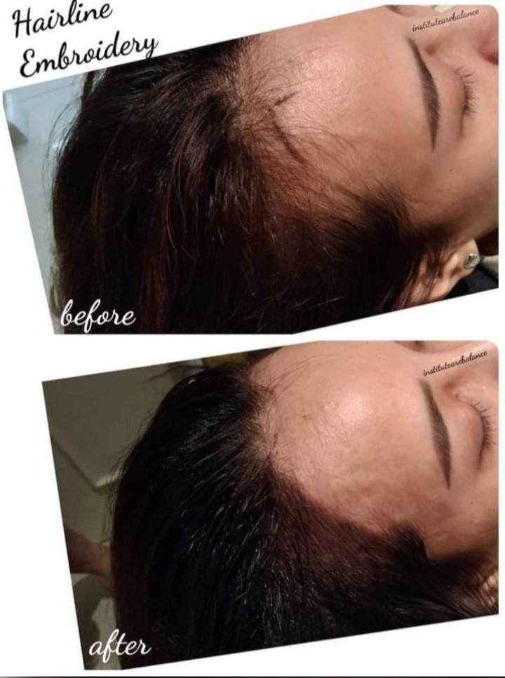 Hairline Embroidery, Lifestyle Services, Beauty & Health Services on