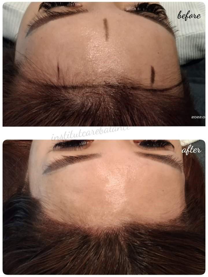 Hairline Embroidery, Lifestyle Services, Beauty & Health Services on