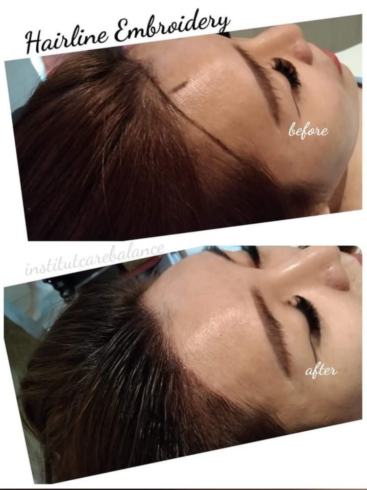 Hairline Embroidery, Lifestyle Services, Beauty & Health Services on