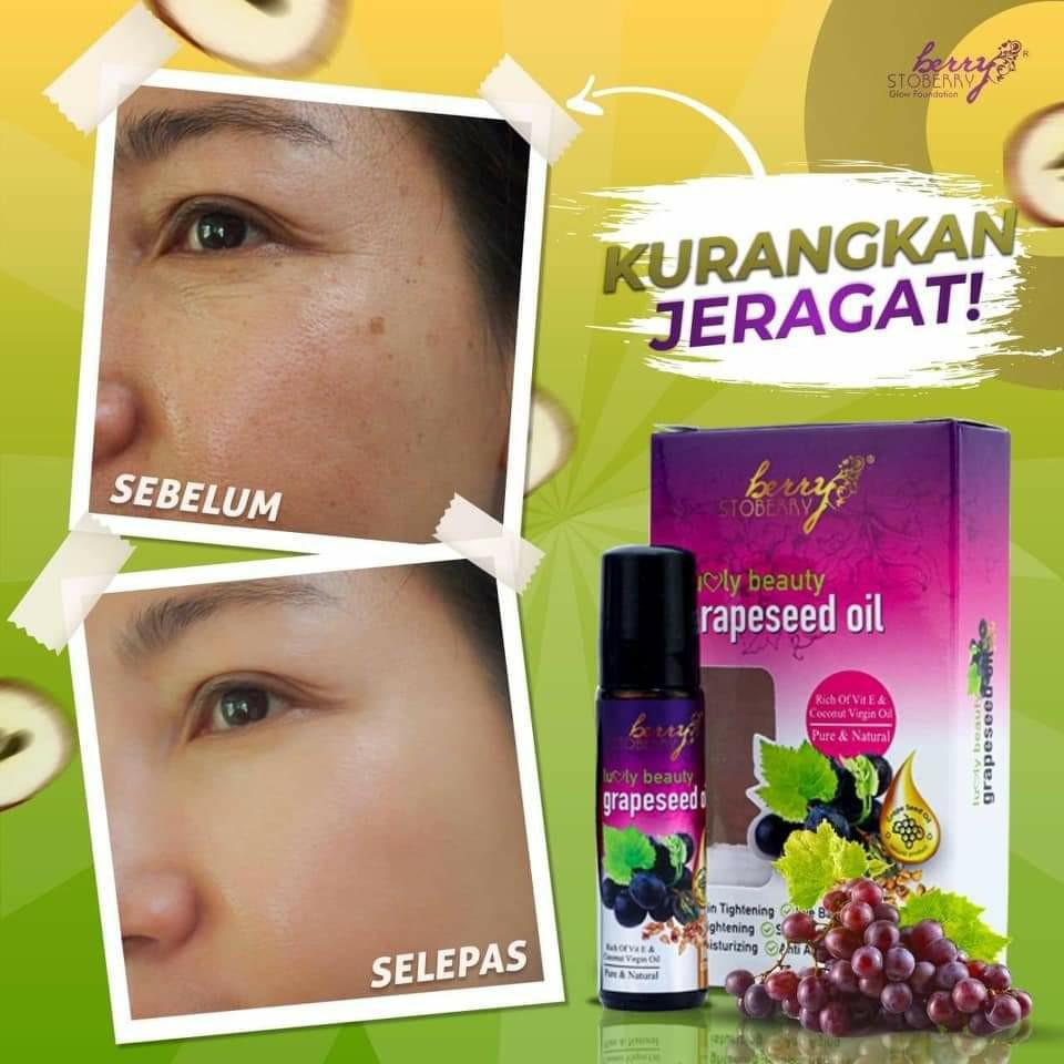 GRAPESEED OIL / ACNE / ECZEMA / EYEBAGS / DARK UNDER EYE / PIMPLE, Beauty & Personal Care, Face