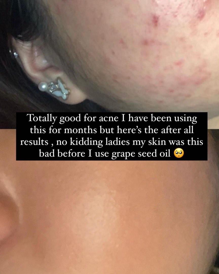 Grapeseed Oil Before And After atelieryuwa.ciao.jp