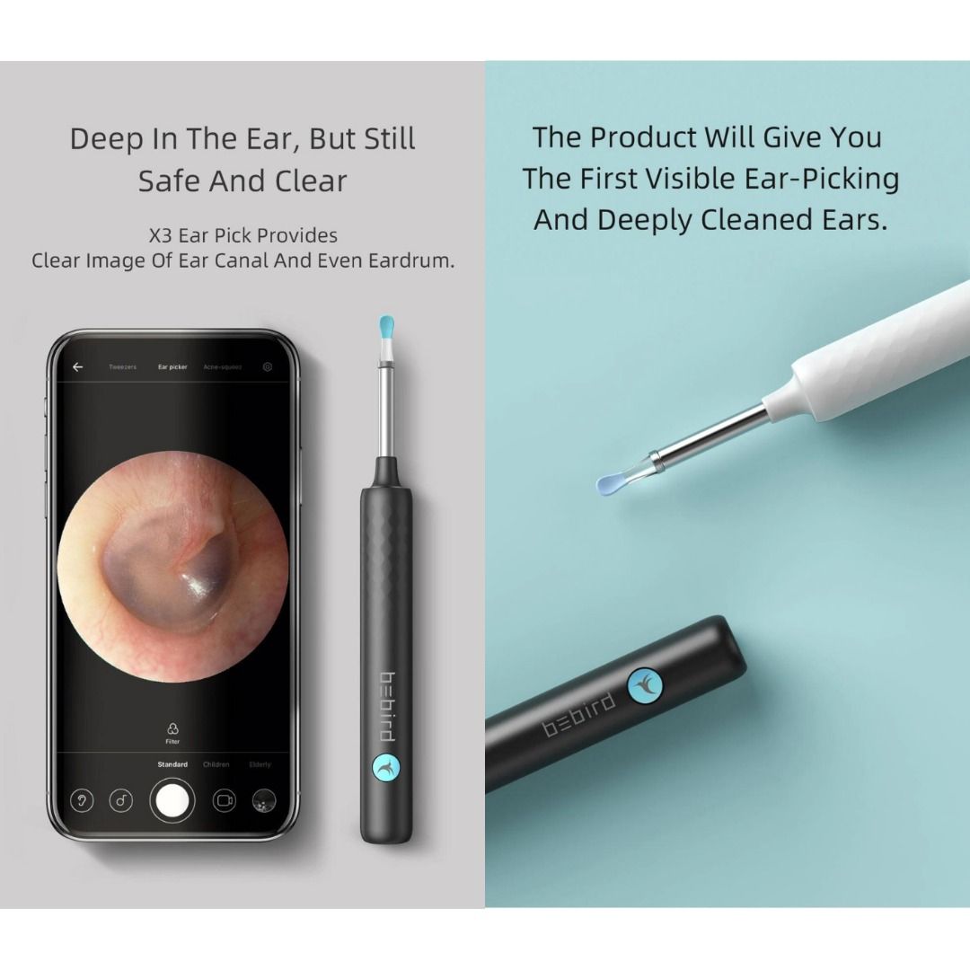 intelligent ear endoscope