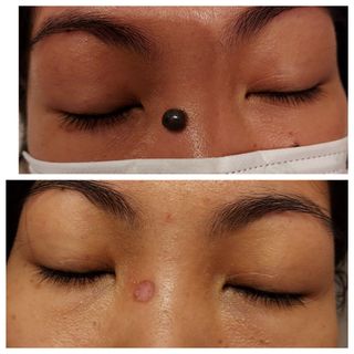 （分類：）位於 。 由 sau97894582 提交（商品編號 1207003596，圖片 1）。簡介： 。