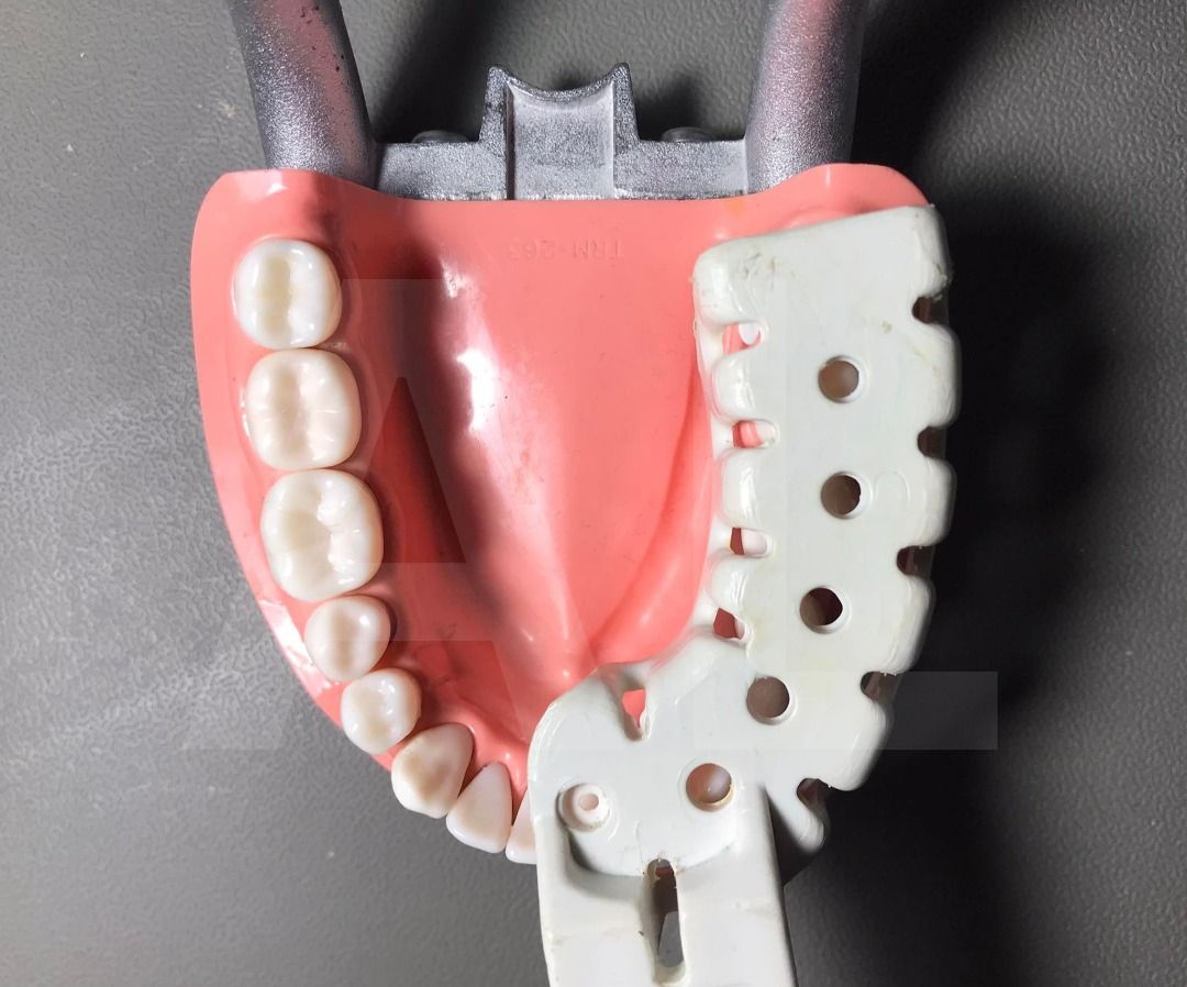 Partial Impression Tray (Plastic) (Category: Medical Supplies & Tools) located in Quezon City. Submitted by ALdent (Listing ID 1212138584, Image 3). Description: ✓ Plastic material ✓ Sonicare brand .