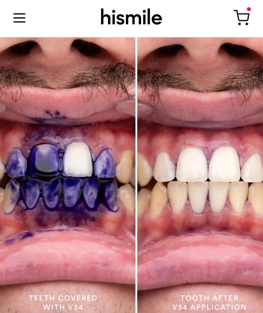澳洲Hismile V34牙齒美白調色精華30g, 美容＆化妝品, 健康及美容- 口腔 