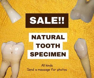 Natural Tooth Specimen