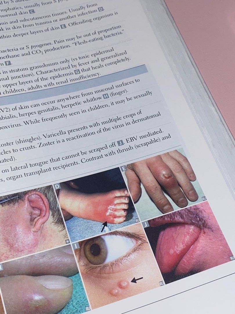 USMLE first aid book 1 (2017 edition), Hobbies & Toys, Books