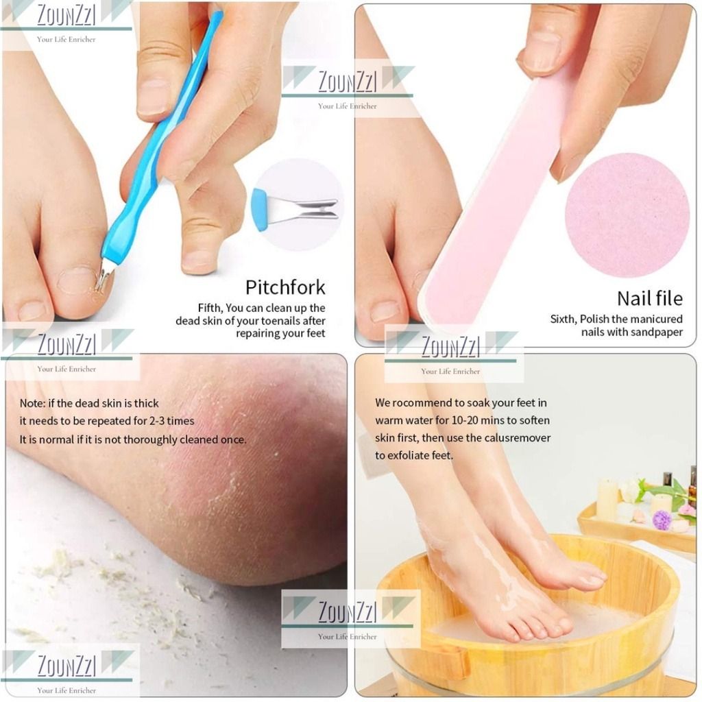 24 Pieces in Total Callus Remover for Feet Set Include 20 Replacement  Blades 2 Callus Shavers Wooden Handle and 2 Foot File Heads Foot Care Tool  Hard Skin Remover for Feet