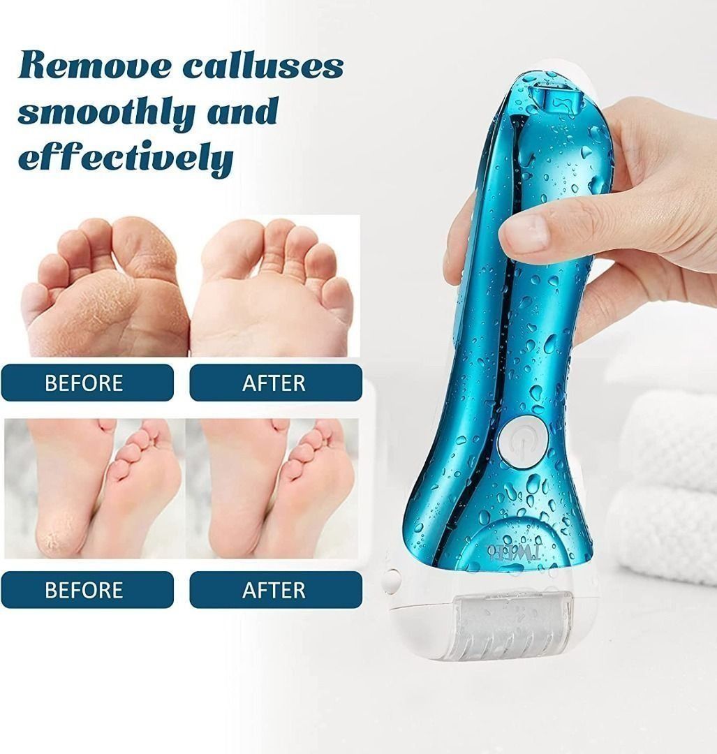 https://media.karousell.com/media/photos/products/2023/10/29/fire_salecallus_remover_for_fe_1698593197_417bad02_progressive