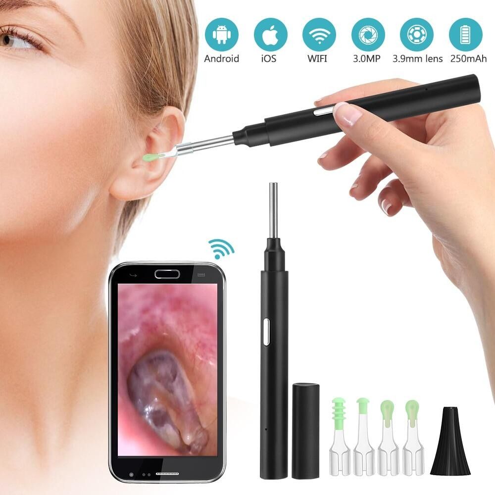 Earwax Remover Kit, Ear Cleaner Ear Vacuum Wax Remover, Painless Soft  Suction Electric Ear Cleaner with LED Light, Safe and Comfortable Silicone  Ear wax Remover Tool with Double Size Head 