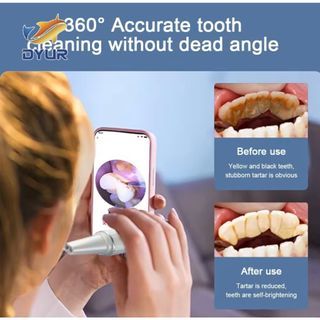 SG Tech Exclusive Intelligent Smart Visual Ultrasonic 800W Pixel Scaler Tooth Cleaner Removal Dental Flosser