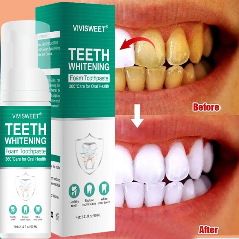 Teeth Whitening Mousse Dental Care Essence Remove Plaque Tooth Stain