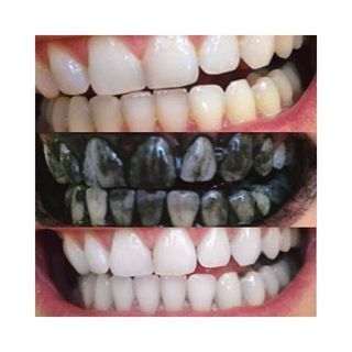 ♥️ Charcoal Powder for Teeth Whitening Natural Whitener