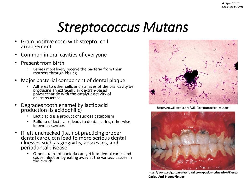 Staphylococcus Aureus/Staphylococcus Mutan, Health & Nutrition, Health ...