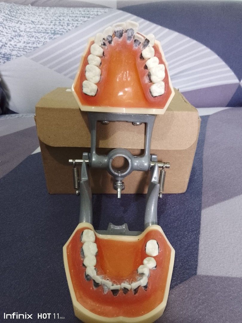 Periodontic Jaw Model (Category: Medical Supplies & Tools) located in Makati City. Submitted by 01fgn (Listing ID 1266852598, Image 2). Description: Periodontic Jaw Model Issue: Yung black stains is nail polish Rfs: Di na nagagamit.