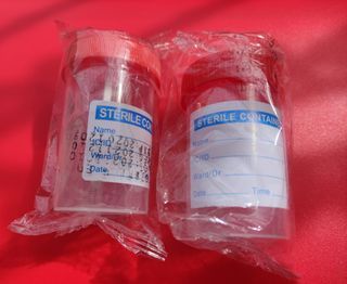 Sterile Urine Cup and Stool Cup (medtech tackle box supplies)