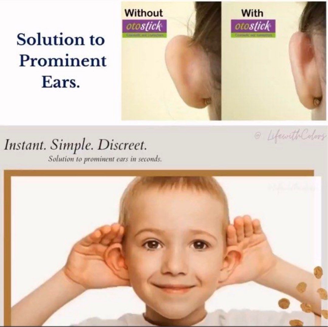 Otostick Ear Correctors For Prominent Ears (Twin Pack )