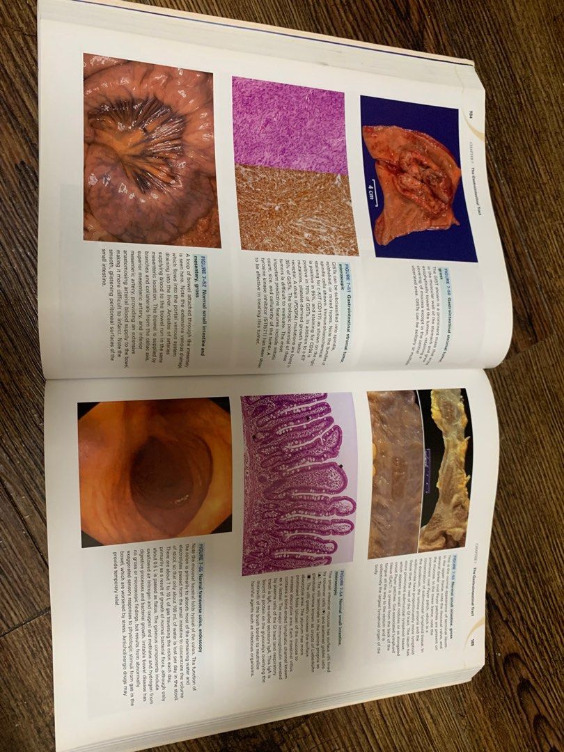 Robbins and cotran atlas of pathology 2nd edition hobbies toys