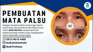 TERPERCAYA!! 0813-4810-4488 (BUDI PROTESA), Pembuat Protesa Mata Palsu di Surakarta, Pasang Mata Prostetik di Surakarta