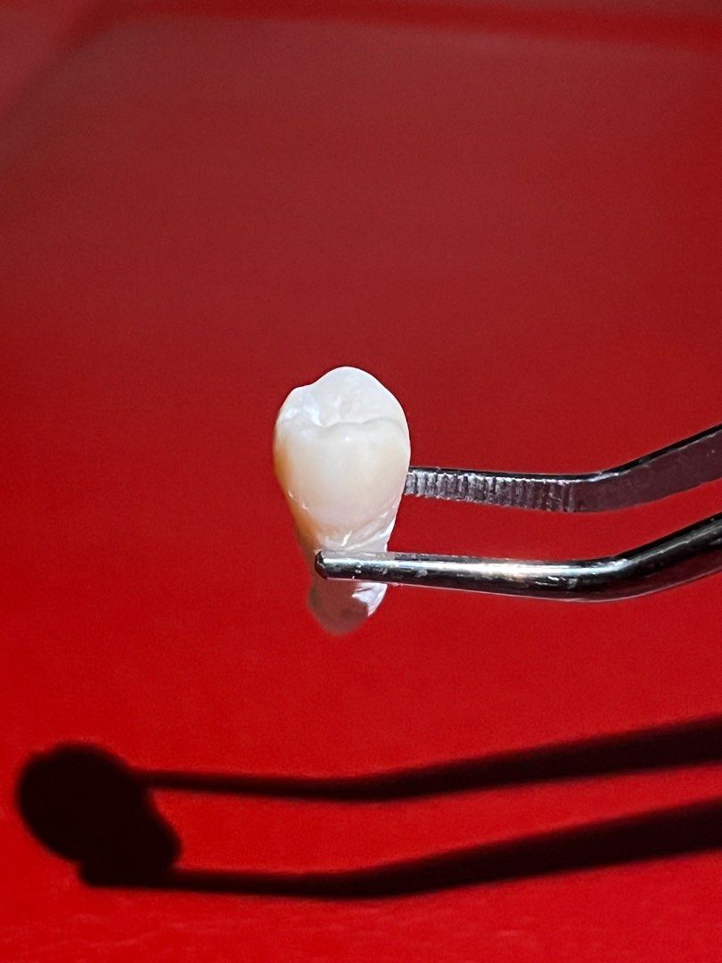 Natural Teeth (Category: Medical Supplies & Tools) located in Taguig. Submitted by mafrd (Listing ID 1214456190, Image 3). Description: P200 each Natural teeth Anteriors Premolars.