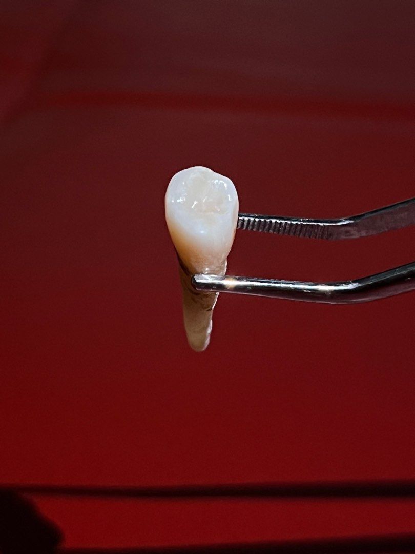 Natural Teeth (Category: Medical Supplies & Tools) located in Taguig. Submitted by mafrd (Listing ID 1214456190, Image 1). Description: P200 each Natural teeth Anteriors Premolars.