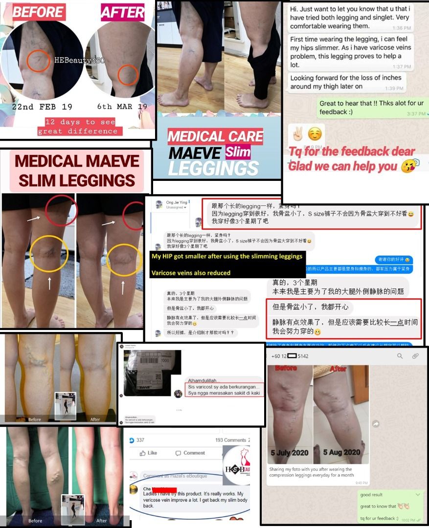 Maeve Medical Leggings for Fat Burning,Varicose Veins BUY 1 FREE 1  (980Denier Day Version) NEW, Women's Fashion, Bottoms, Other Bottoms on  Carousell