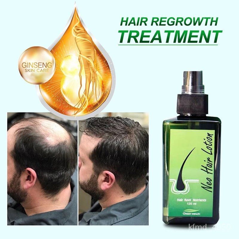 Neo Hair Lotion Oil Spray Original, Beauty & Personal Care, Hair on  Carousell
