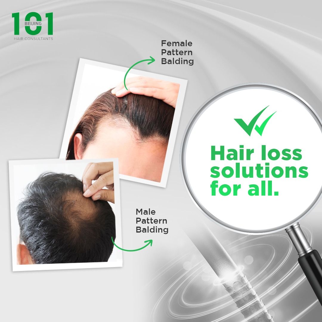 Prime Hair Growth Enhancer Treatment | For Hair Loss / Hair Thinning /  Balding / Receding Hairline, Lifestyle Services, Beauty & Health Services  on Carousell