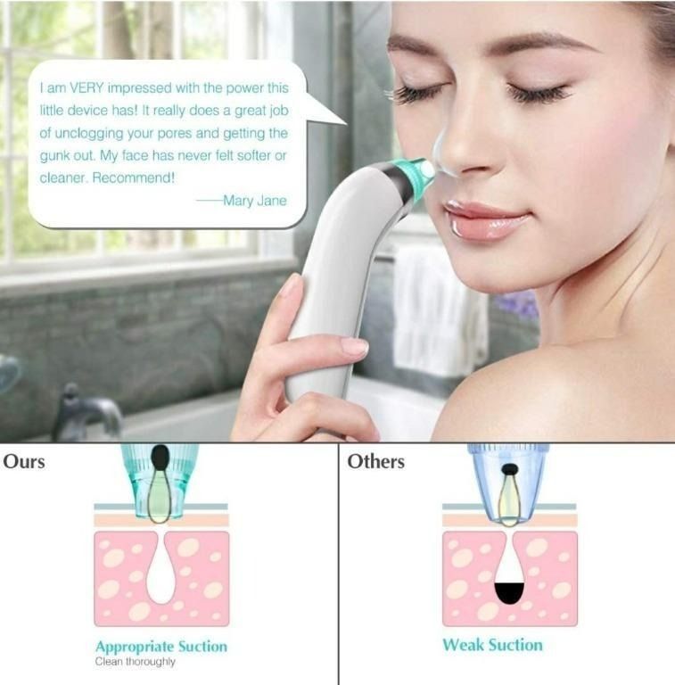 FitFort Pore Vacuum Suction Skincare Device, Beauty & Personal Care