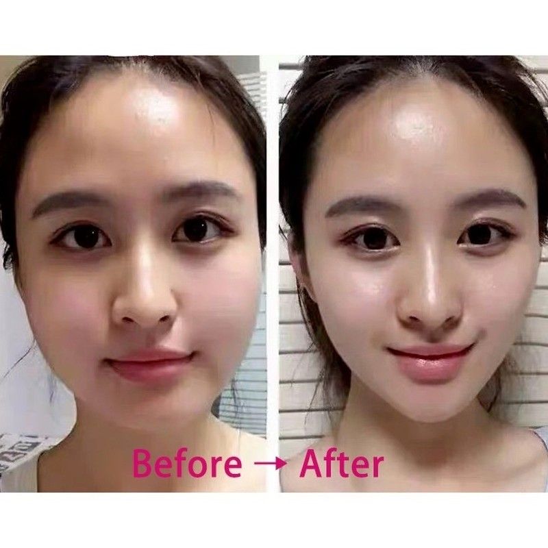 Facial Slimming Belt face shaper small face shaper slim face wrapper V life  sleeping mask neck and chin shaper lifting band Korean V shape face small  face shaper, Beauty & Personal Care