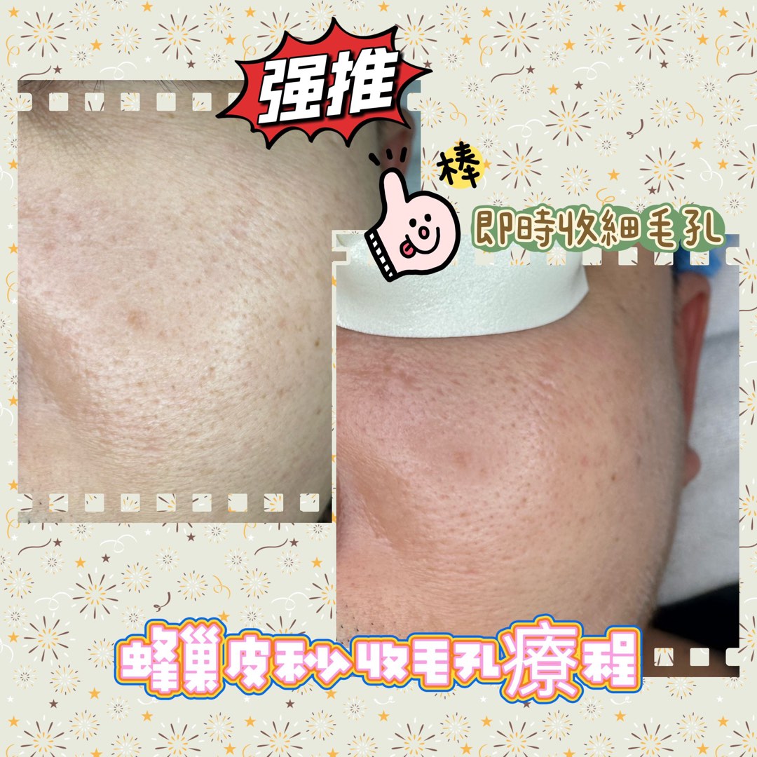 (分類:)位於 。 由 Girlstore 提交(商品編號 1217523829,圖片 1)。簡介: 。