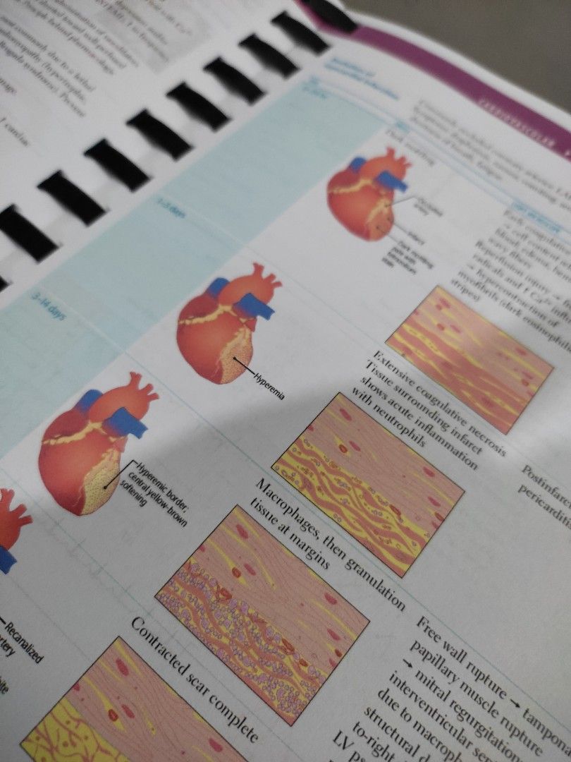 FIRST AID USMLE Step 1 2020 Edition (Booklet Size) (Category: Textbooks) located in Manila. Submitted by beeeee. (Listing ID 1217924692, Image 3). Description: FIRST AID USMLE STEP 1 2020 EDITION Slightly used Less than 20 pages of highlights and writings Spring bound Note: I removed the pages in the first chapter (Guide to Efficient Exam Prep) to make it easier to open the book since I didn't need it for my study sessions. ALL MEDICAL/EDUCATIONA