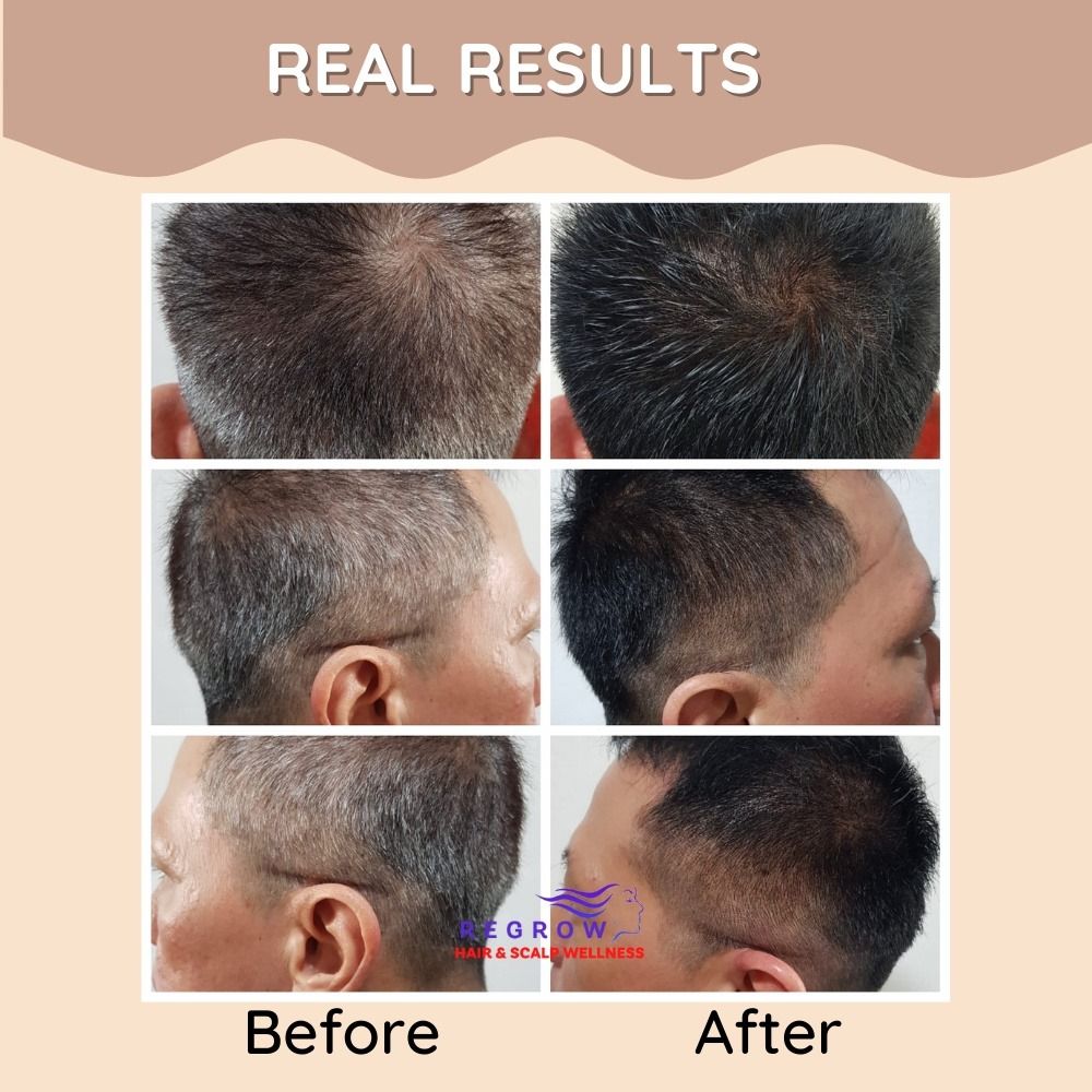 Herbal Hair Colouring Scalp Treatment Powder (100g) FREE Hair Dye Set - DIY  Hair Color Dye, Beauty & Personal Care, Hair on Carousell