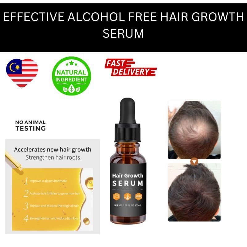Natural Hair Growth Serum To Combat Hairloss, Aloepecia And Scalp Related  Problems, Beauty & Personal Care, Hair on Carousell