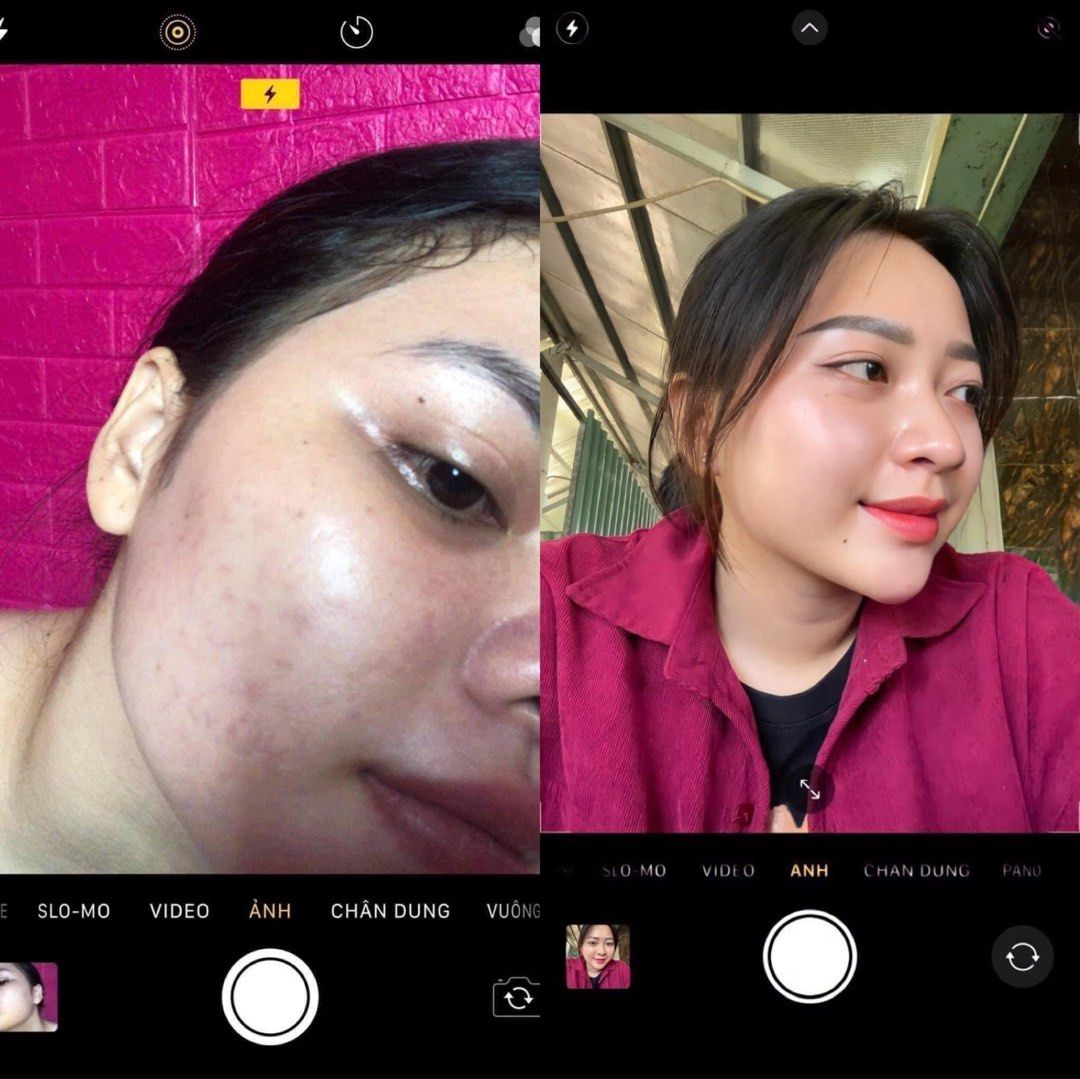 Hoshi Japanese cream, Beauty & Personal Care, Face, Face Care on Carousell