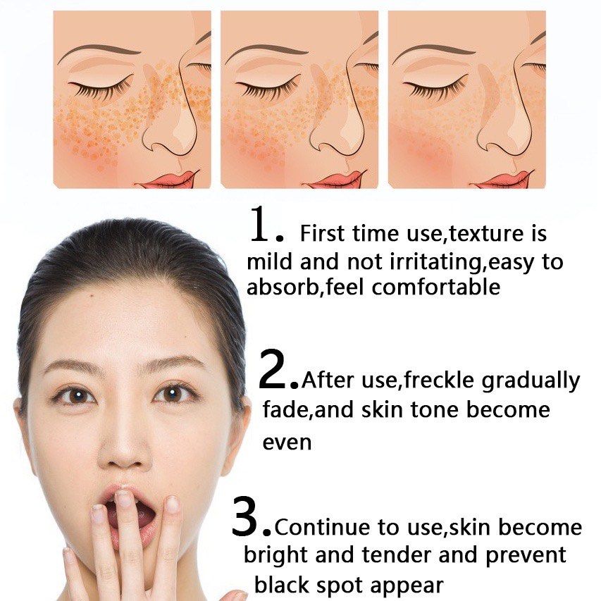 LAFUNNI Whitening Freckle Cream Face Moisturizing Remove Dark Spots