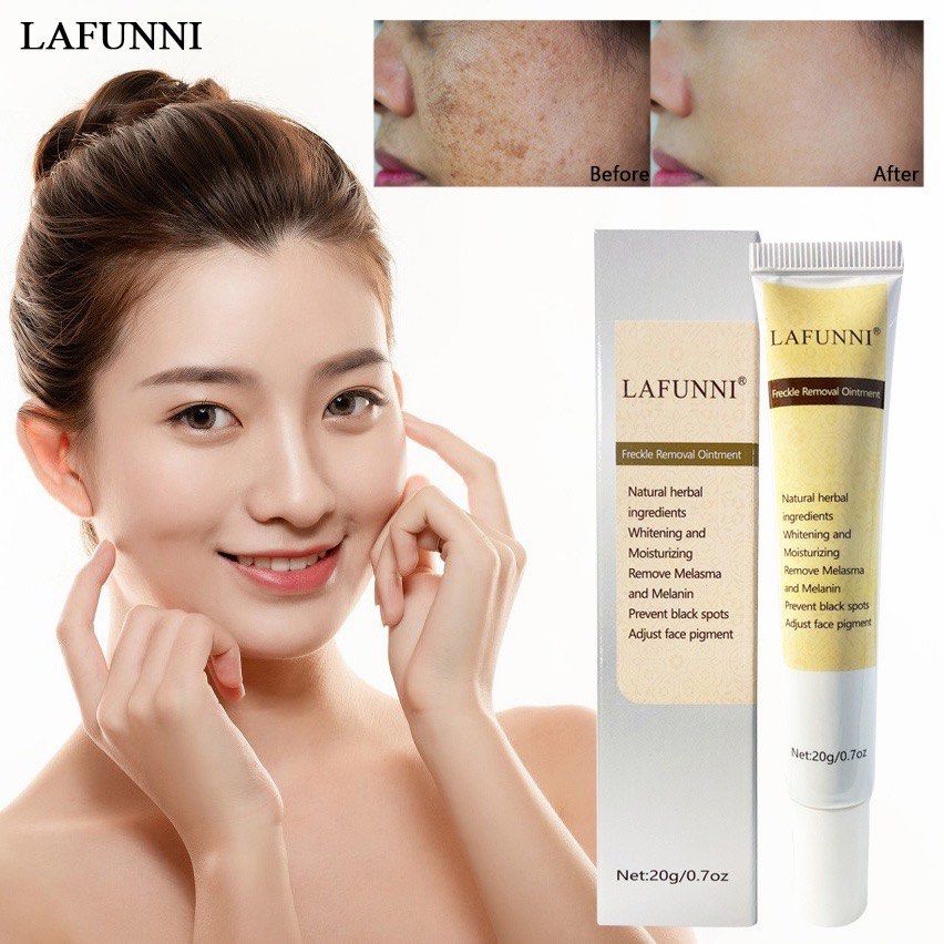 LAFUNNI Whitening Freckle Cream Face Moisturizing Remove Dark Spots