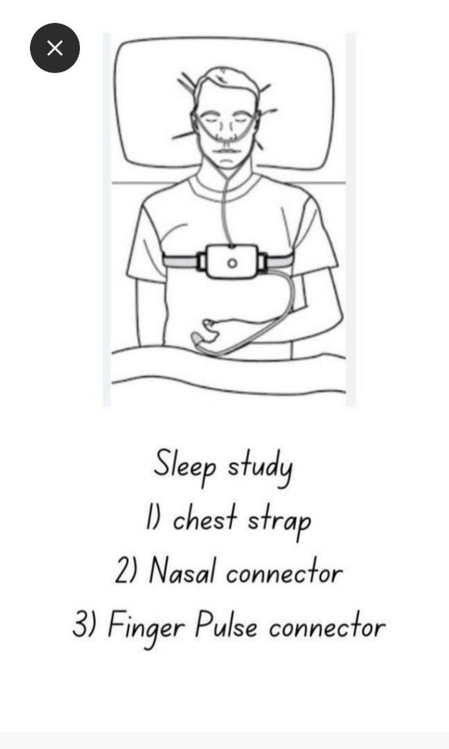 Sleep study test (Sleep apena /OSA), Health & Nutrition, Health