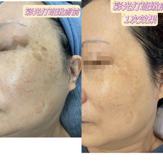 （分類：）位於 。 由 kat2020 提交（商品編號 1200104191，圖片 1）。簡介： 。