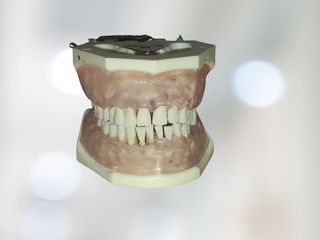 Periodontal Jaw Model (TRIMUNT)
