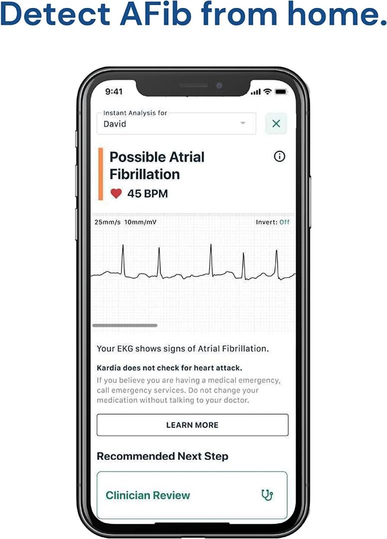 KardiaMobile Personal EKG Device and Heart Monitor SingleLead EKG