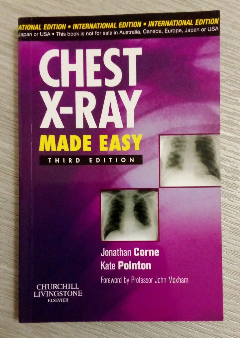 Chest XRay Made Easy, Hobbies & Toys, Books & Magazines, Textbooks on