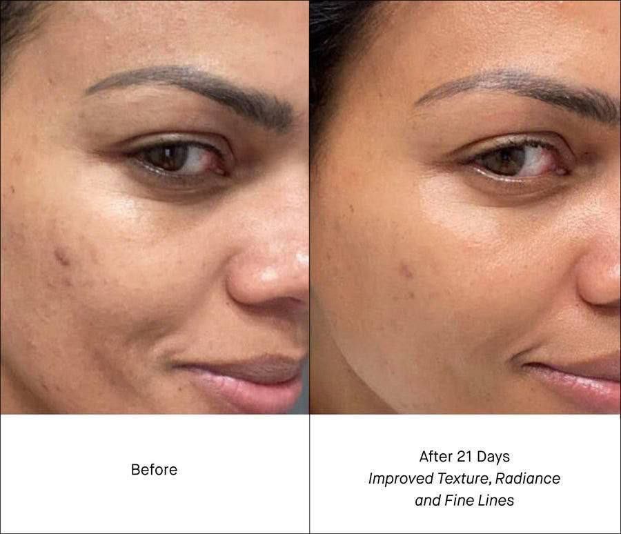 Shani darden retinol store