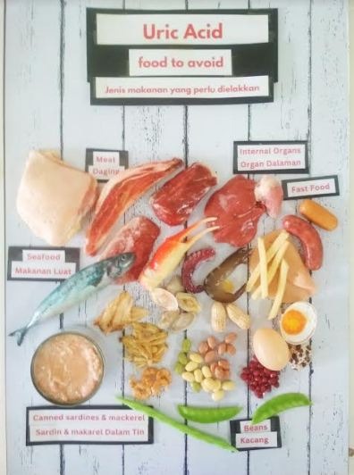 "uric acid food to avoid""Paparan jenis makanan yang perlu dielakkan